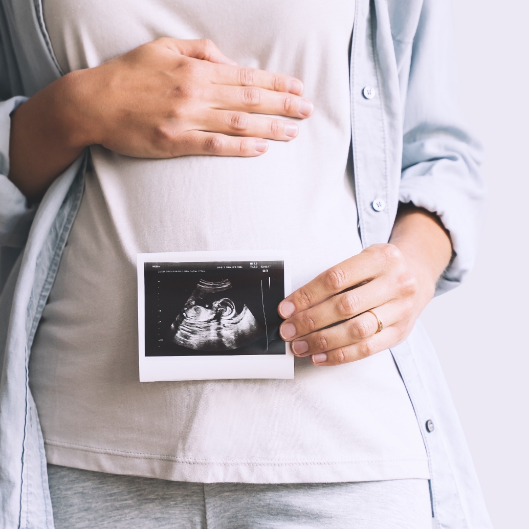 Diagnosi rapida delle cromosomopatie fetali mediante QF-PCR