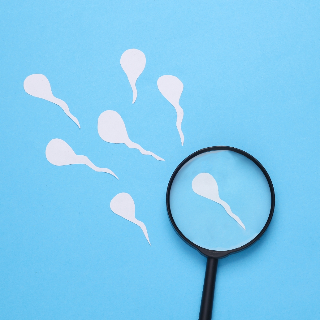 Azoospermia: sintomi, cause e opzioni terapeutiche