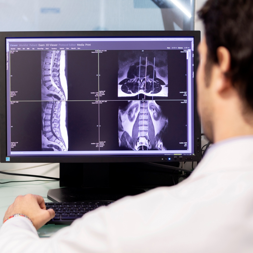 Risonanza magnetica aperta: a cosa serve e benefici